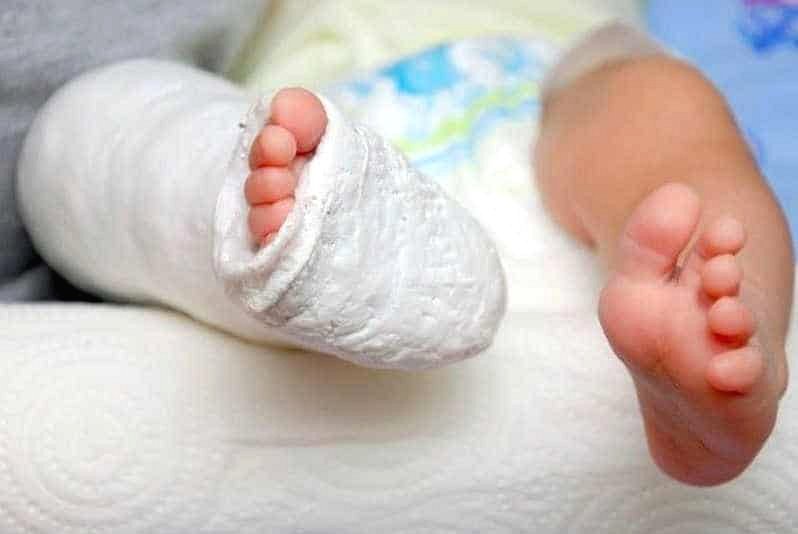 Thạch cao trong lĩnh vực y tế